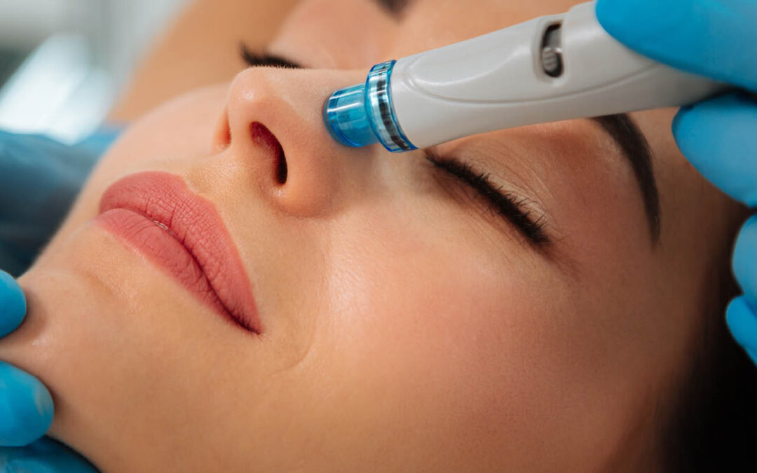 HydraFacial in London