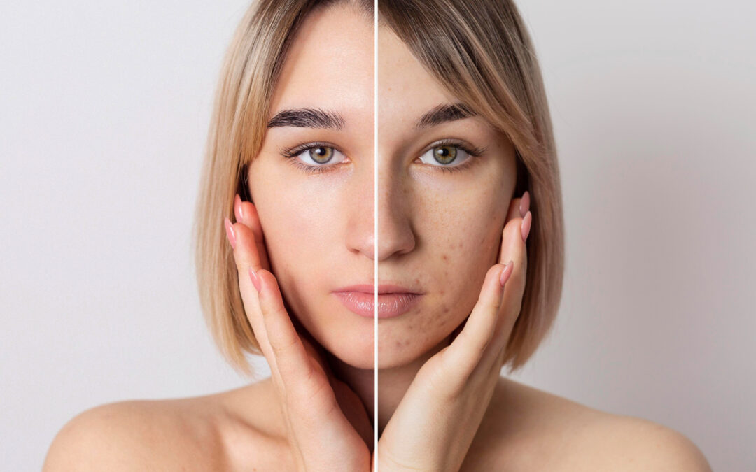 Radiant Skin at Any Age: Your Guide to Premier Anti-Aging Treatments in Birmingham